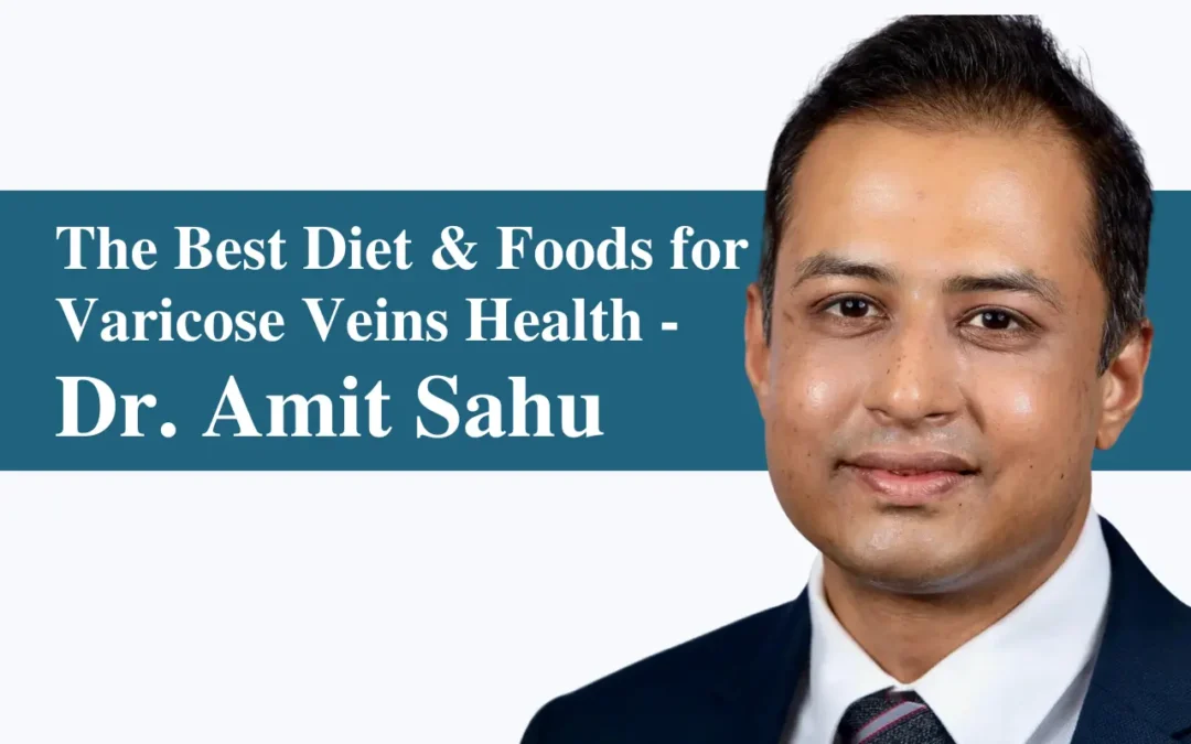 Best Diet and Foods for Varicose Veins Health