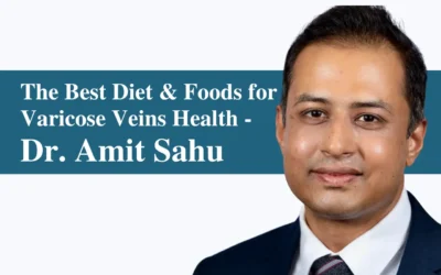 Best Diet and Foods for Varicose Veins Health