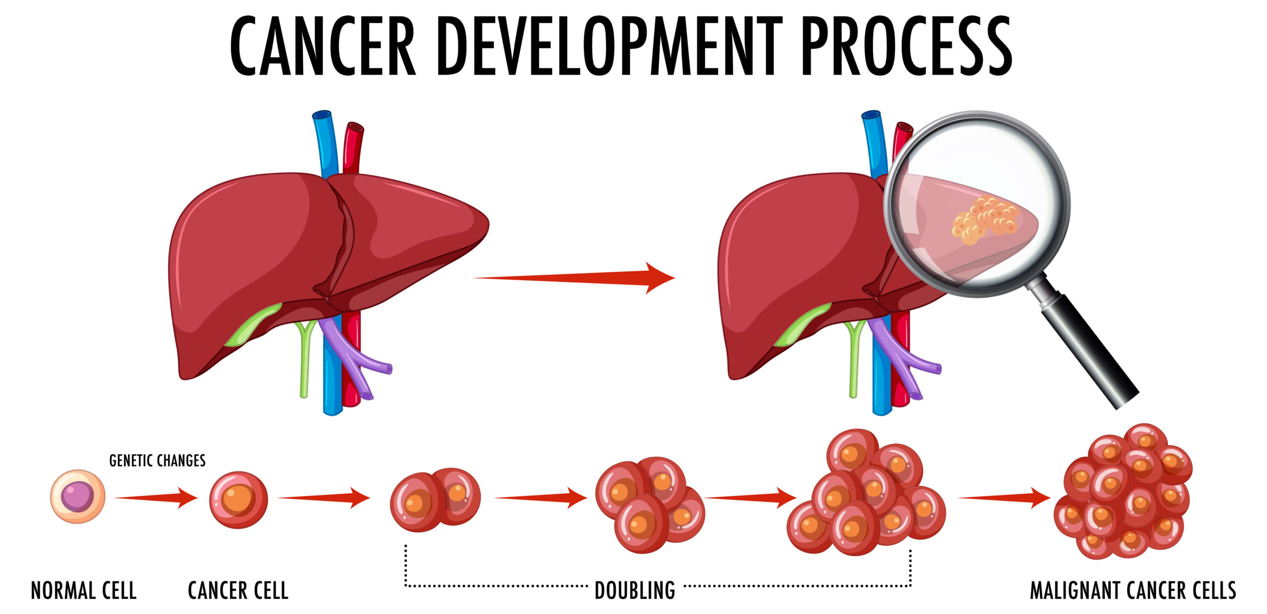 liver cancer developement process