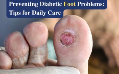 How to Prevent Diabetic Foot Problems