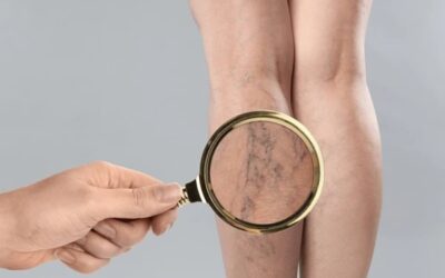 Future Trends in Non-Surgical Vein Care