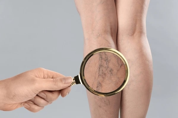 Future Trends in Non-Surgical Vein Care